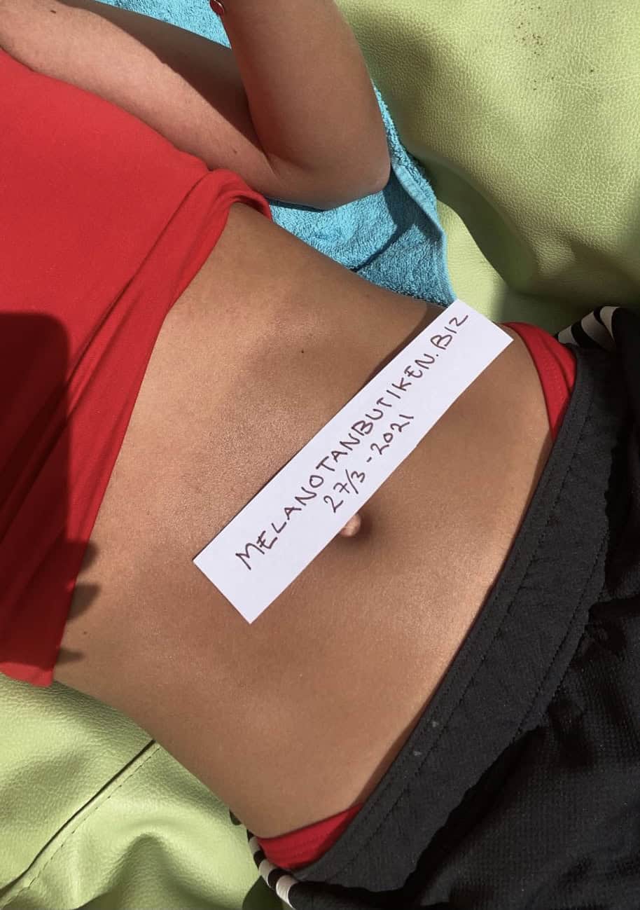 Melanotan före efter resultat